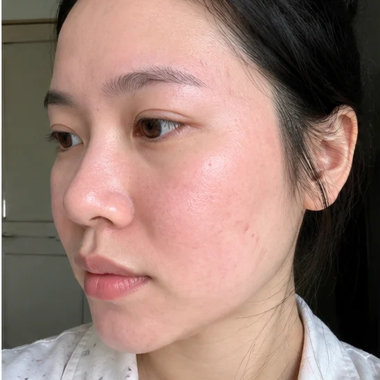 Tuần thứ 2 - Tái tạo màng lipid bảo vệ da