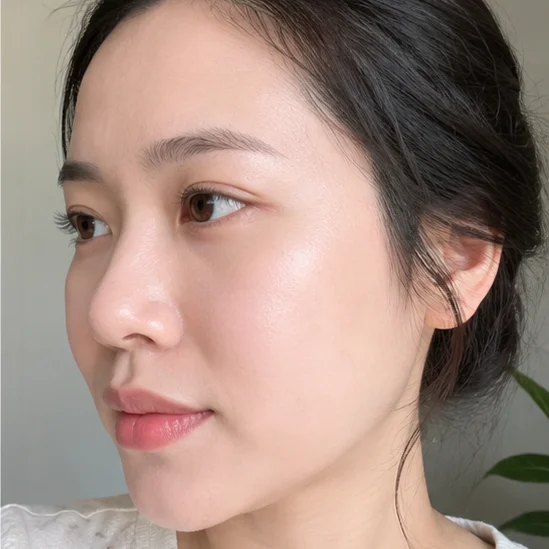 Tuần thứ 4 - Kết quả nền da dày khỏe, lặn gân máu